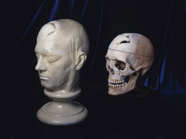 Phineas Gage02 Phineas Gage02